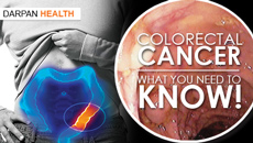 Colorectal Cancer: What You Need To Know!